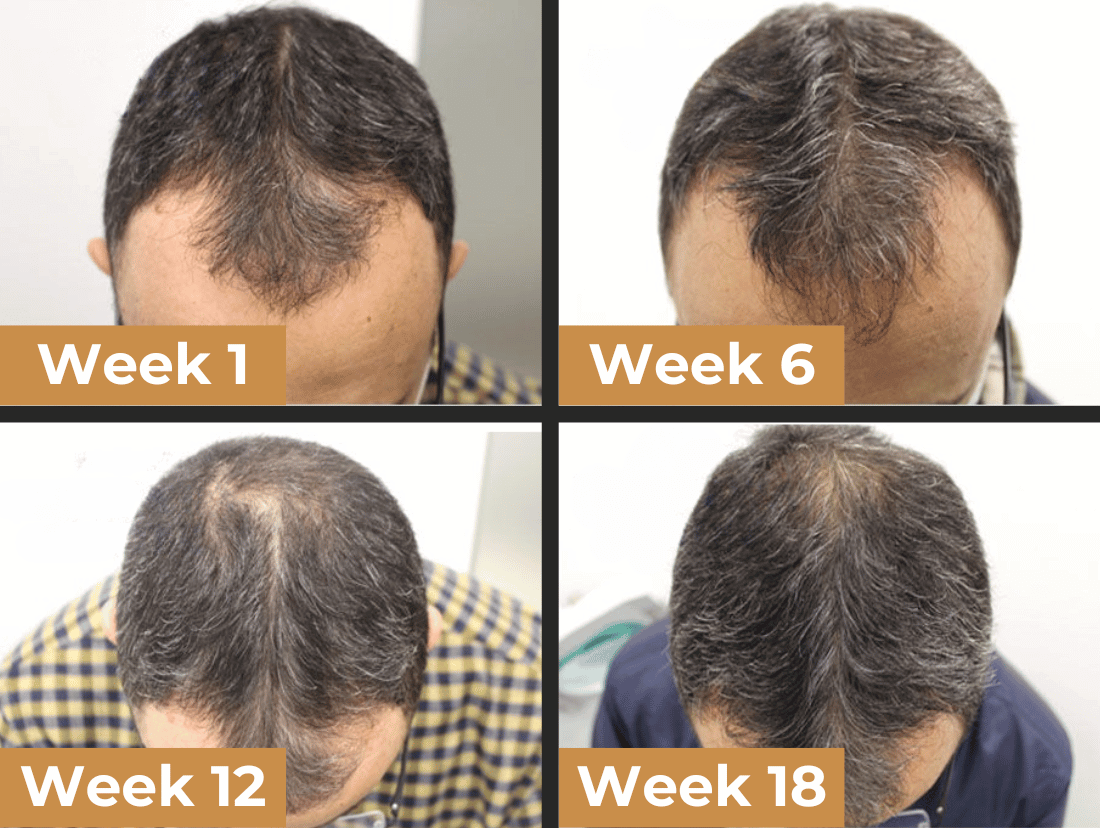 Visible results over weeks