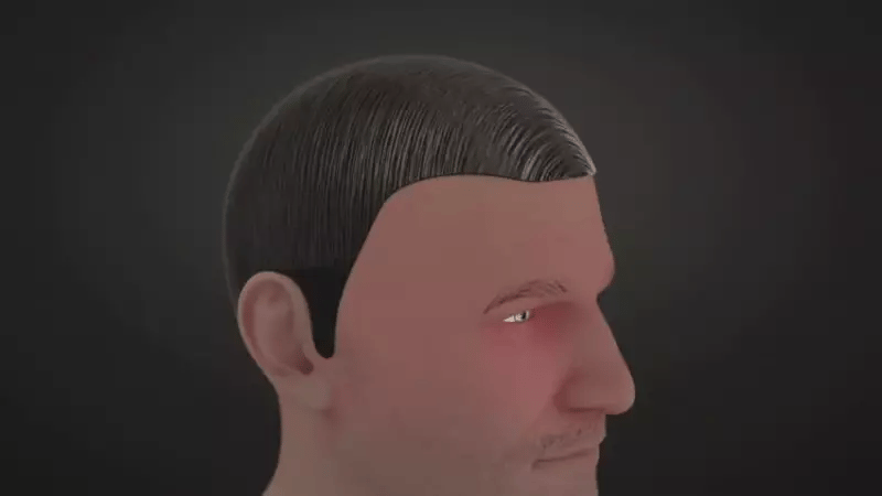 Hair loss illustration